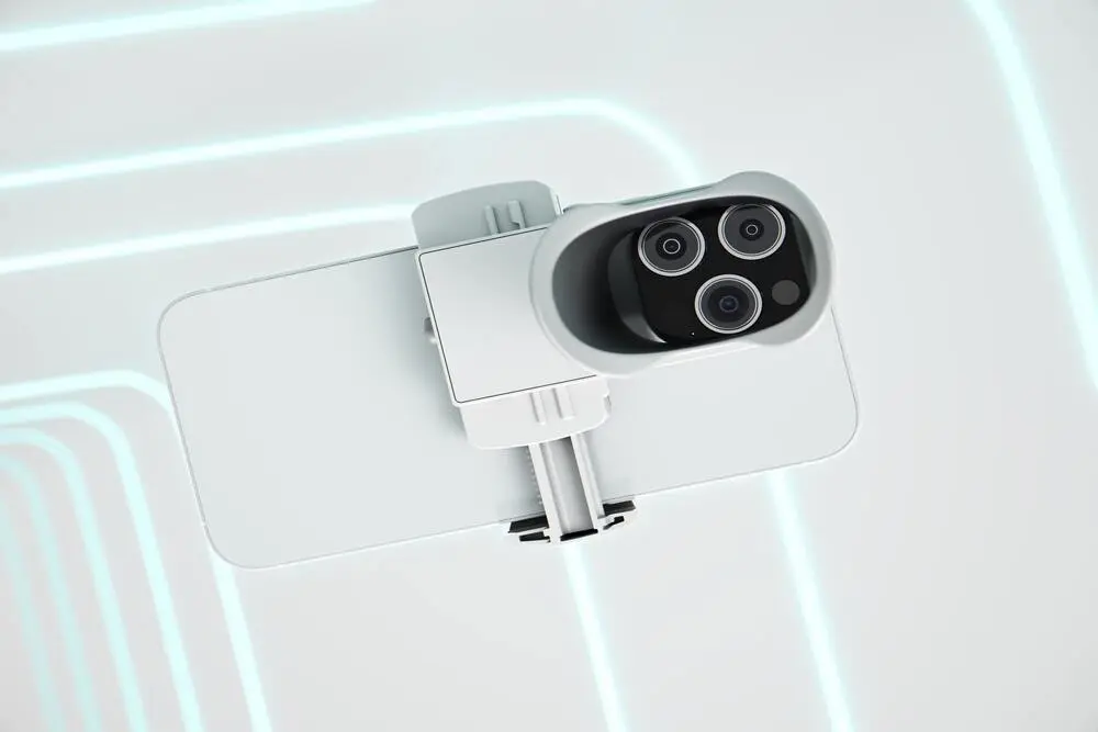 Appareil Dental Monitoring pour suivi orthodontique à distance