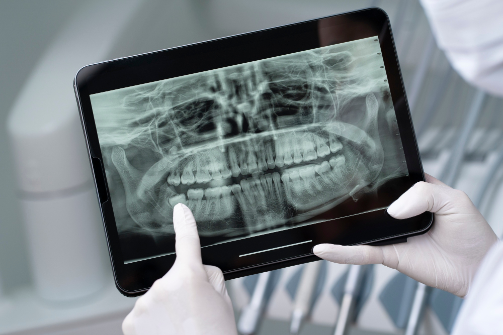 Analyse radiographique assistée par intelligence artificielle